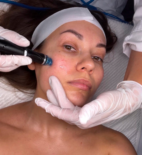 girl doing a hydrafacial 
